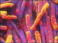 + C Diff The Organism Gram + bacillus Anaerobic Spore forming Intestinal flora (up to 35%