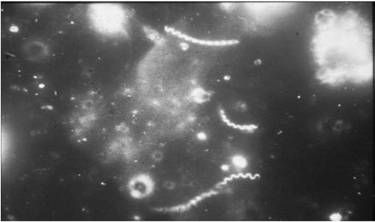 Syphilis Treponema pallidum on darkfield Few clinics have darkfield microscopes Few clinicians know how to use them Syphilis
