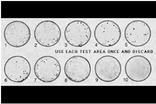 Serologic Tests for Syphilis Two types Treponemal