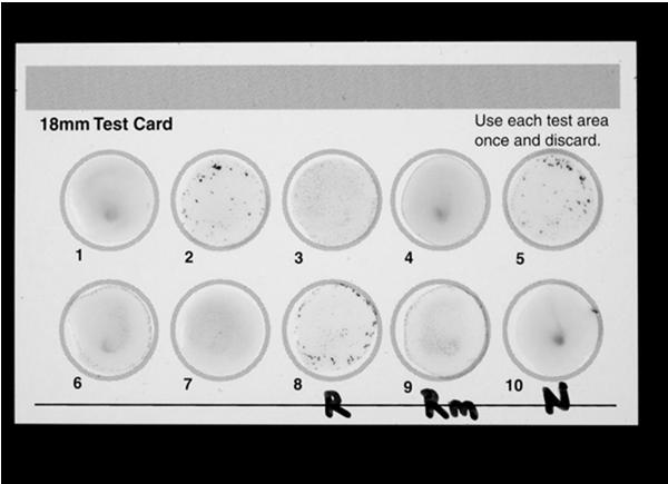 Screening Tests for Syphilis Nontreponemal tests RPR Card