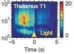 New insights into post-stroke epilepsy Thalamocortical neurons become
