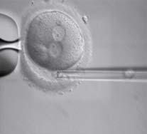 Fresh Embryo Transfer 1 st & 2 nd Polar Body Biopsy Array CGH Analysis ESHRE PGD Task