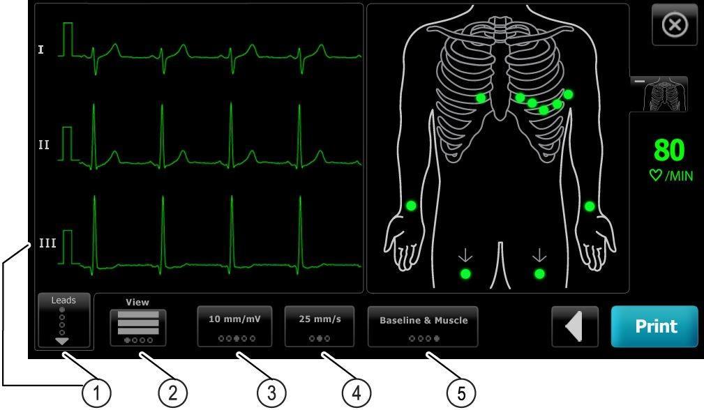 6 CP 150 12-lead resting electrocardiograph 4. Enter the following patient information as desired: Gender Race Height. Touch the OK button. Weight. Touch the OK button. Comments. Touch the OK button. 5.