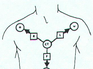 Precordial or chest (Unipolar) leads V1-4 th intercostal space at Rt sternal boarder V2-4 th intercostal space at Lt sternal boarder V3 - midway between V2 and V4 V4-5 th intercostal space in