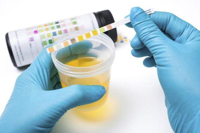 check urine: check ph with a procedure called a dipstick test, and also chemicals contents (like sugar,