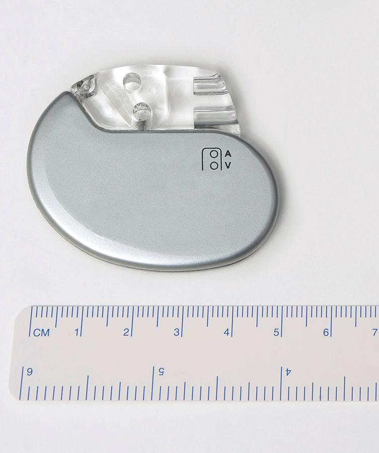 Artificial pacemaker - ICD The heart has a natural pacemaker to make it beat normally. If that s not working reliably, an artificial pacemaker can be inserted to do the same job.
