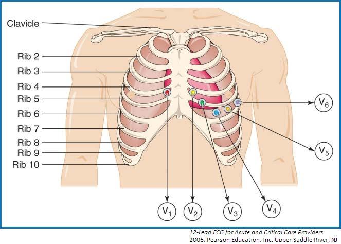 40.7 ECG electrode placement: Precordial Leads