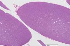 corpuscles Urinary pole macula densa JG