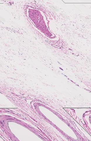 VENULE capillary Nerve arteriole