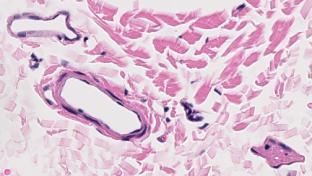 epithelium MUSCULAR ARTERY AND