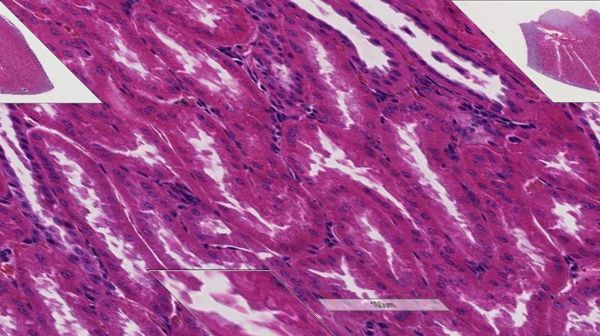 parietal layer of the glomerular