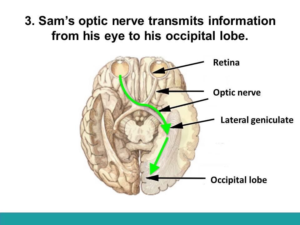 Sam s optic nerve transmits information from his eye to the his occipital lobe. Ask the students to describe the orientation of this brain.