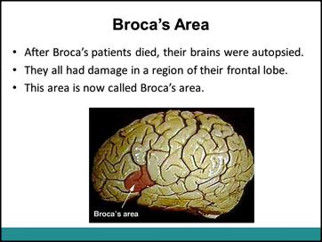 Through autopsy, Broca found that the posterior region of the frontal lobe was damaged in all of his patients. This area is now called Broca s area.