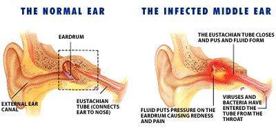 ABOUT 60% OF EAR