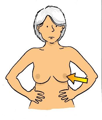 part of your breast Any changes in the shape,