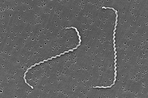8 General principles of infectious diseases Figure 1.8 Scanning electron micrograph of Leptospira species. Image provided by Rob Weyant.