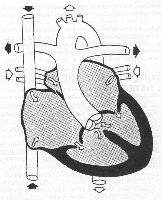 Truncus Arteriosus Aorta and pulmonary artery are the same