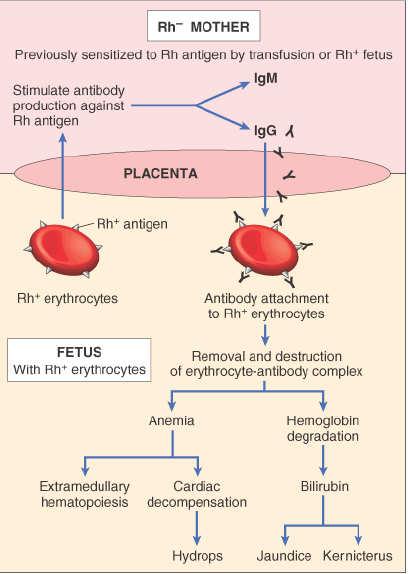 Pathogenesis of erythroblastosis Ref: Robins Pathological Basis of
