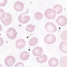 Plasmolysis Cell