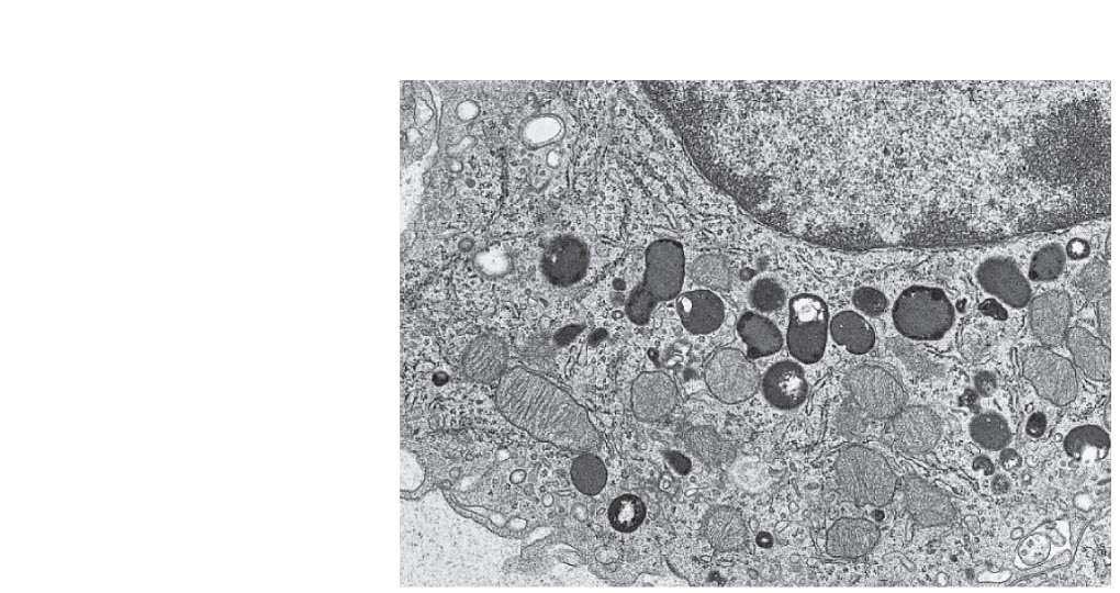 Fig. 6-14a Nucleus 1 µm
