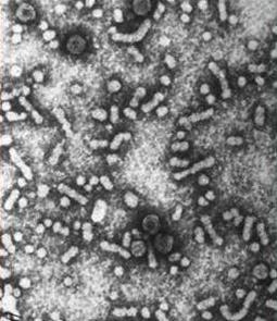 Hepatitis B Virus (HBV) 1.