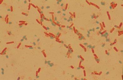 11 Fig. Bacillus cereus spores with green colour stain Common sources of infection include: Raw, dried or processed foods such as cereals, cornflower, spices, and other dried foods.