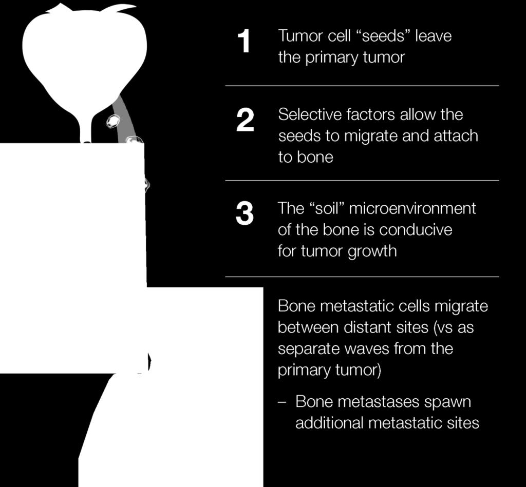 The Concept of Bone Mets Spawn More Bone Mets 1 Recently Demonstrated The bone matrix is fertile soil that stimulates growth of tumor cells 2 The same tumor cells travel from site to site and