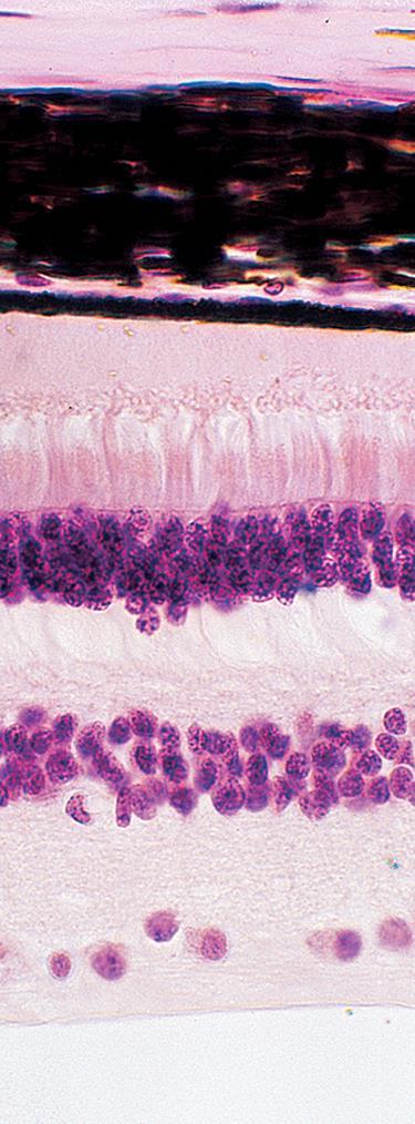 Micrograph of retina Biophoto
