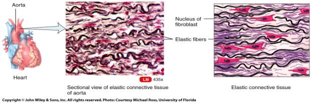 Elastic Connective Tissue consists of fibroblasts and freely branching elastic fibers It allows stretching of certain like the elastic arteries