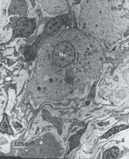 of granular cells.