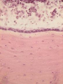 inner bone surface One cell layer--> osteoprogenitor