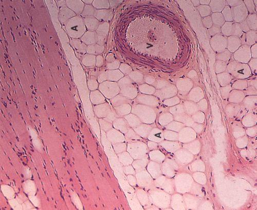 Adipose cells Unilocular: White Adipose -fat storage -scant ring of cytoplasm signet ring