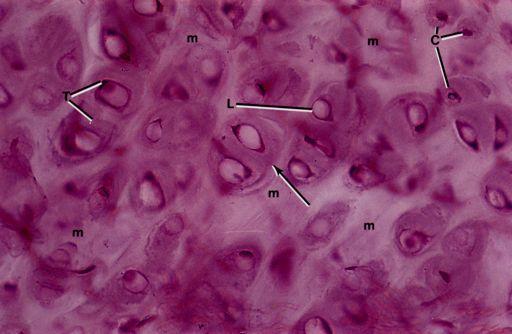 Cartilage growth!interstitial!division of pre-existing chondrocytes: isogenous groups!