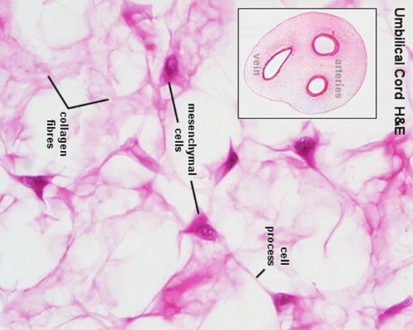Reticular CT Reticular cells Network of reticular fibers Hematopoietic organs