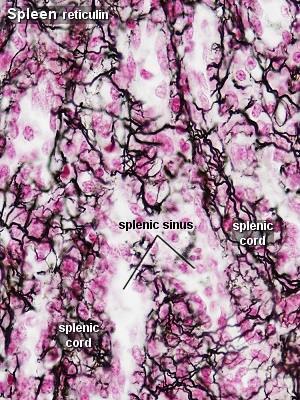 Spleen Reticular fibers,