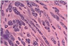 Collagen Chondrocytes Bones protect organs, allow for movement, store minerals, sites