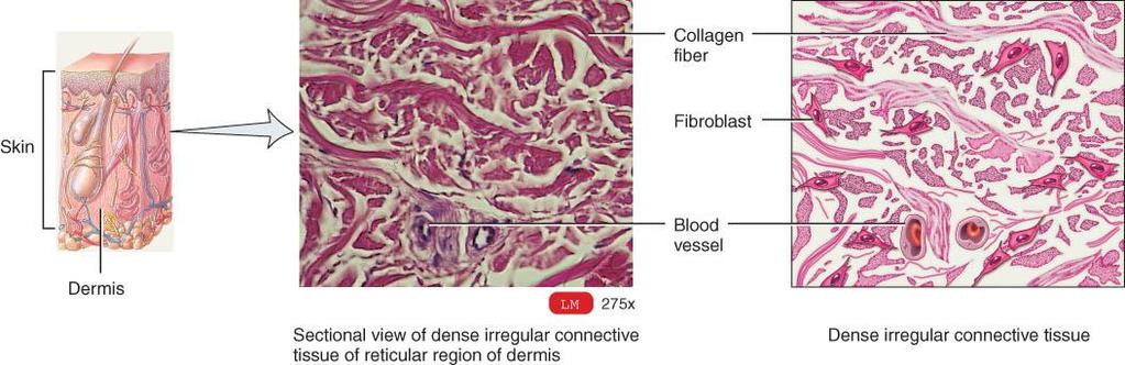 2B: DENSE IRREGULAR CONNECTIVE TISSUE o Contains collagen fibers that are irregularly arranged and is found in parts of the body where tensions are exerted in any direction occurs in sheets, such