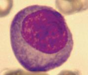 debris by phagocytosis - Plasma cells develop from B