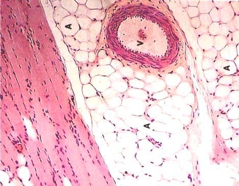 mitochondria poorly developed RER SER