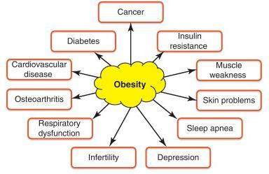 obesity Hyperplastic obesity Genetic influences There is no question that profound genetic influences affect weight regulation.