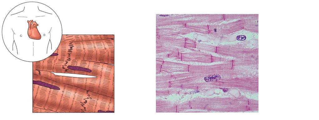 Figure 3.20b Type of muscle tissue and their common locations in the body.