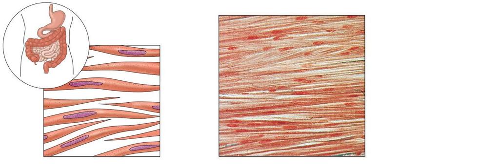Figure 3.20c Type of muscle tissue and their common locations in the body.