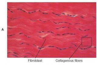 fibers Cells are fibroblasts Irregular