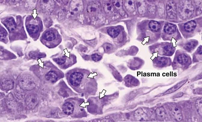 (3) Plasma cells: 1) Origin: 2)