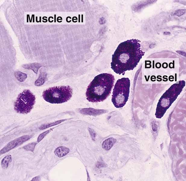 (4) Mast cells: usually