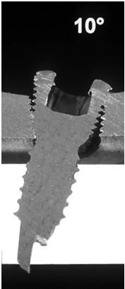 d) Jammed locking head screws (LHS) Seldom do all LHS come out easily.
