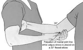 Elbow/Wrist/Hand Pointers Elbow Injuries -break elbow into 4 quadrants -Lateral -Medial -Posterior -Anterior 1. Lateral Epicondylosis (Tennis Elbow) a. extensor supinator tendinopathy b.