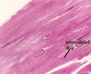 Cardiac muscle Found only in the HEART Striated involuntary Cardiac muscle cells are