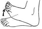 Special Movements (occur only at certain joints Dorsiflexion: lifting