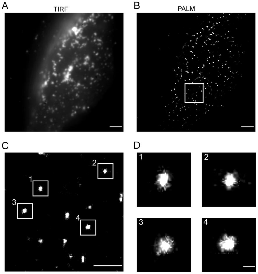 Figure 1. Distribution of Gag.mEosFP at the plasma membrane of HeLa cells imaged by super-resolution TIRF microscopy. HeLa cells were transfected with equimolar amounts of pchiv and pchiv meosfp.